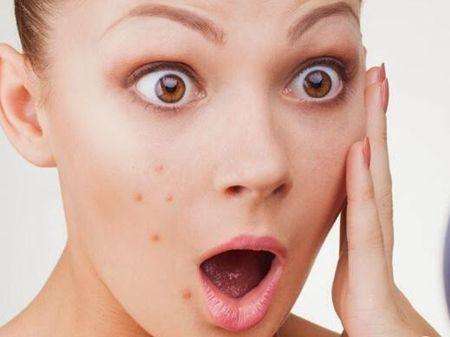 為什么說有針對性調(diào)理才能更好地祛痘呢？